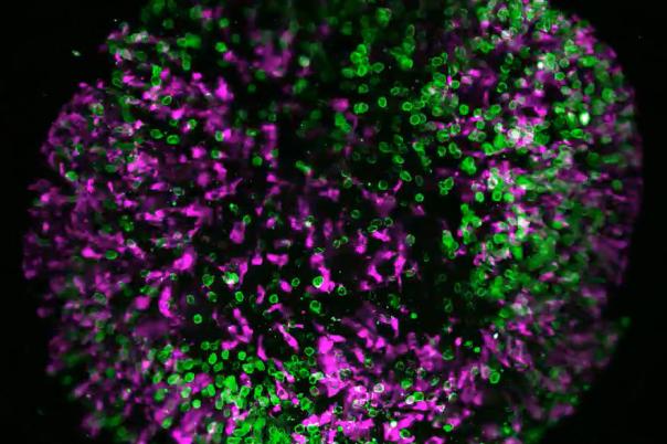 eBook: Overcoming Barriers in Organoid Imaging and Analysis 