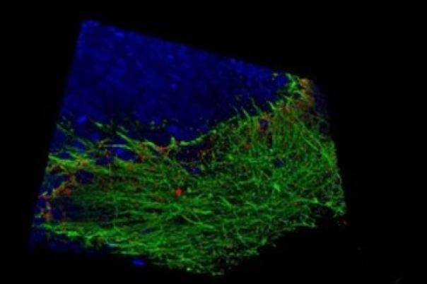 Webinar: Unlocking the Secrets of Organoid Models in Biomedical Research 