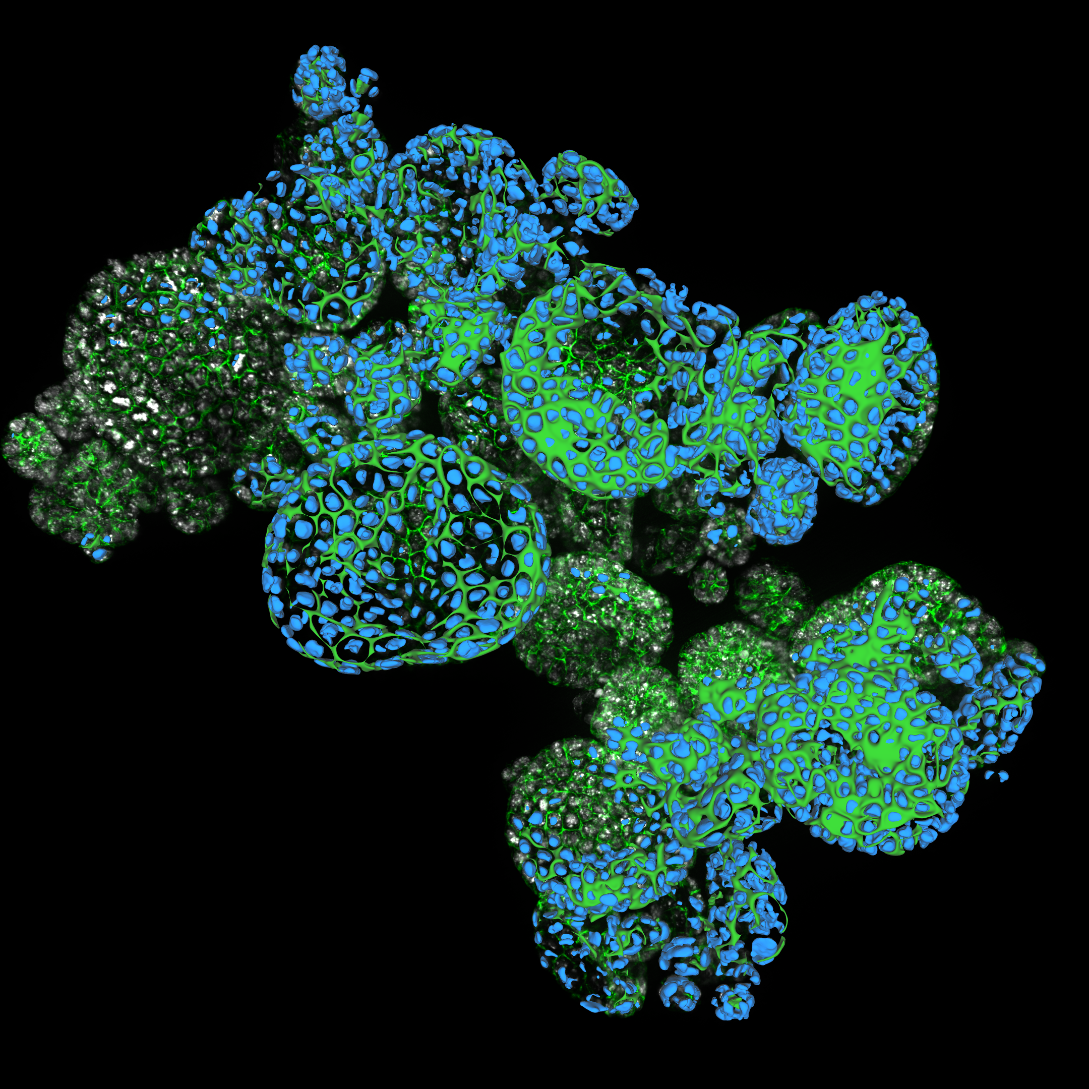 Webinar: How Efficient is your 3D Organoid Imaging and Analysis Workflow? 
