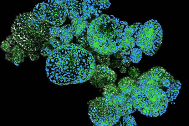 Webinar: How Efficient is your 3D Organoid Imaging and Analysis Workflow? 