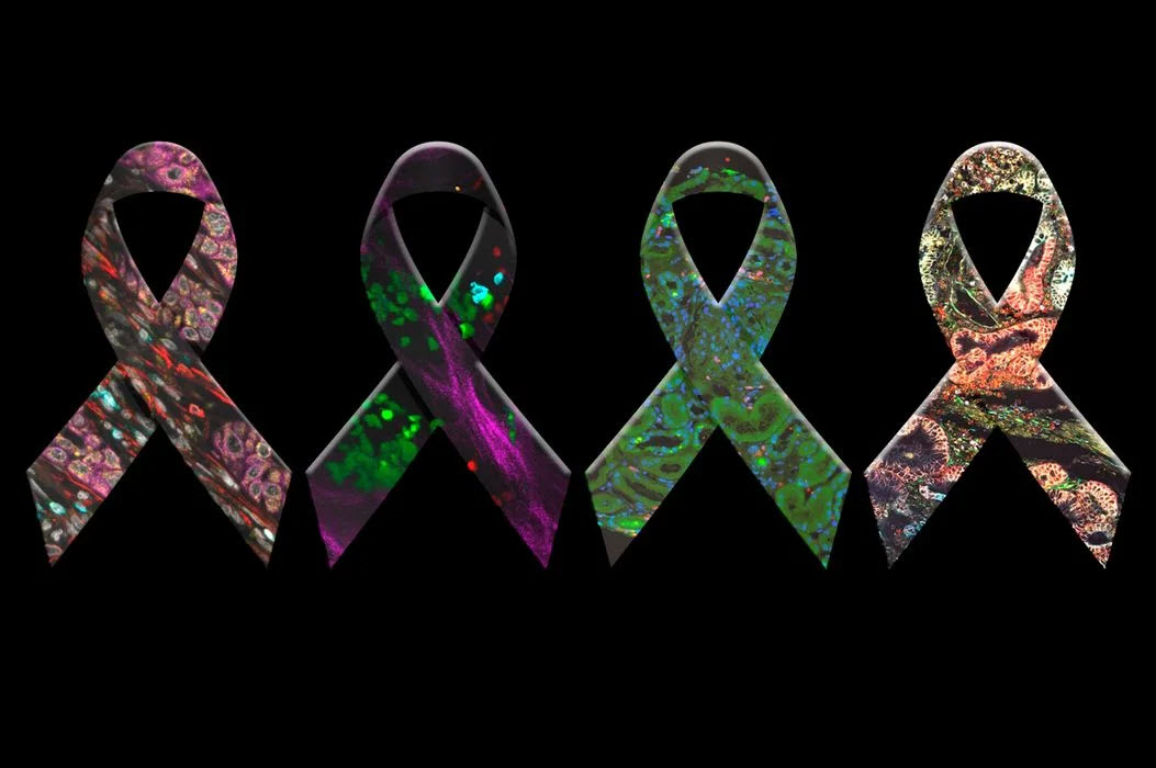 eBook: History, Developments and Trends of Microscopy in Cancer Research 