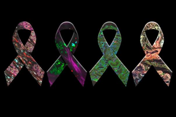 eBook: History, Developments and Trends of Microscopy in Cancer Research 