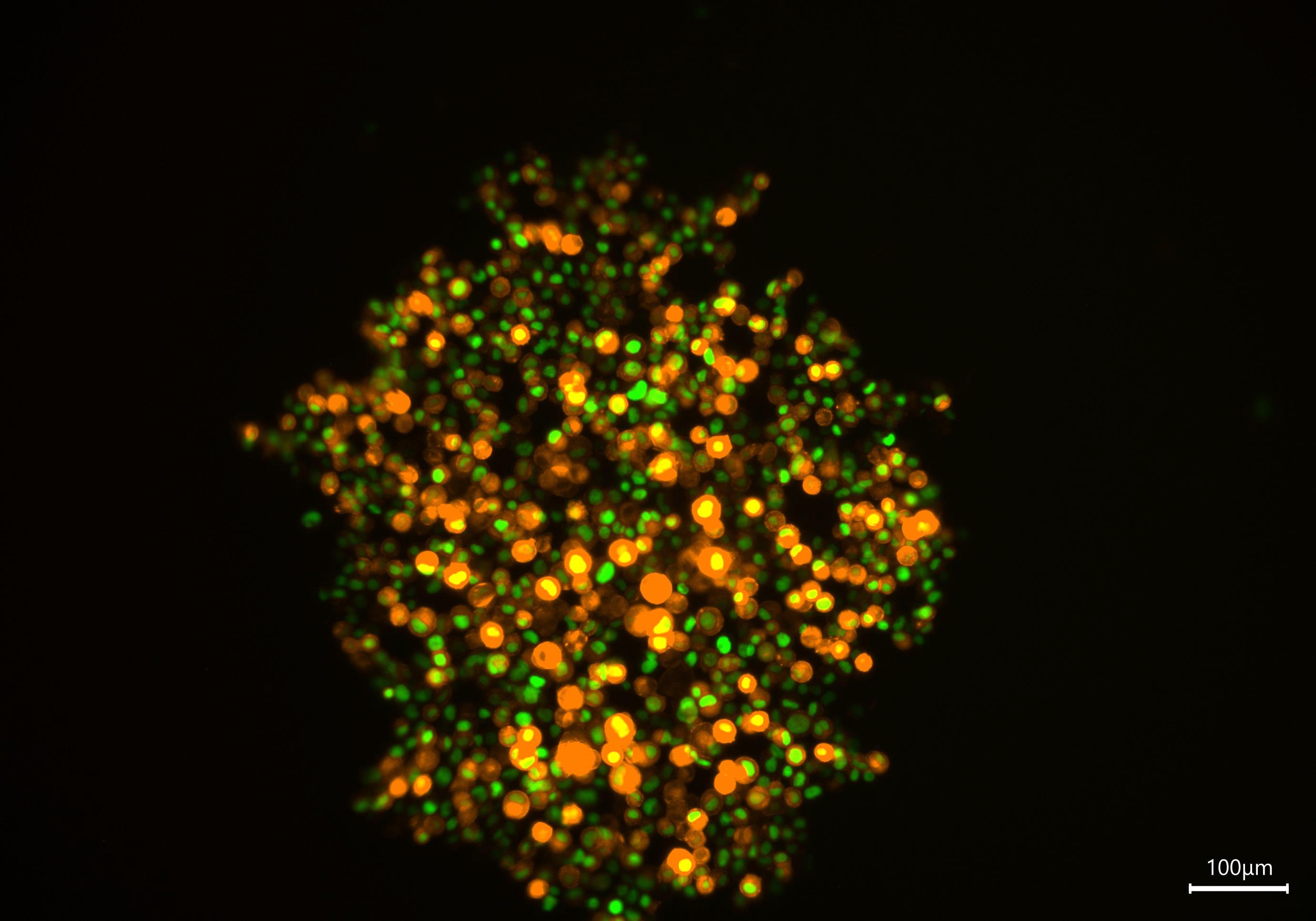 App Note: Overcoming Observational Challenges in Organoid 3D Cell Culture 