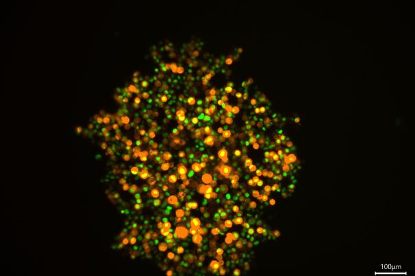 App Note: Overcoming Observational Challenges in Organoid 3D Cell Culture 