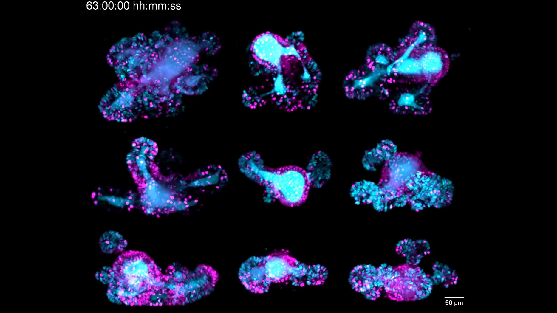 Focus on Long-Term Imaging in 3D with Light Sheet Microscopy 