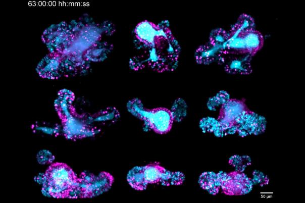 Focus on Long-Term Imaging in 3D with Light Sheet Microscopy 