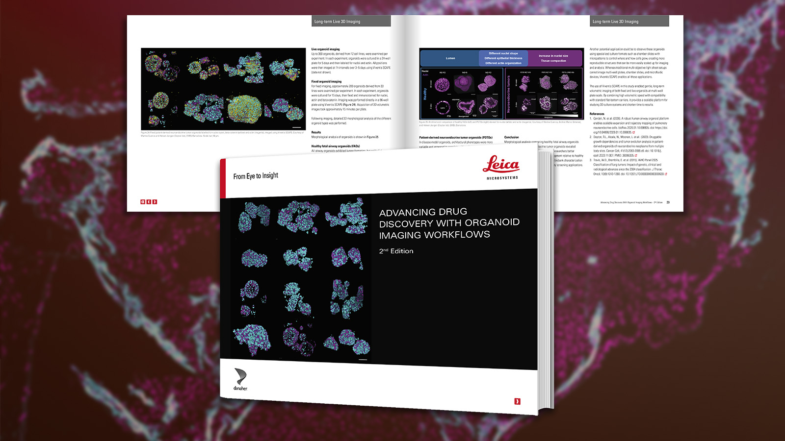 eBook: Advancing Drug Discovery with Organoid Imaging Workflows
