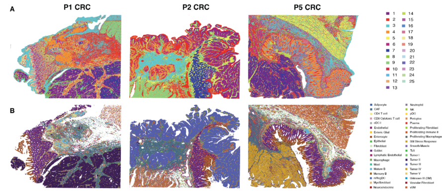 How mapping the spatial biology of the tumor microenvironment can benefit cancer drug discovery and development