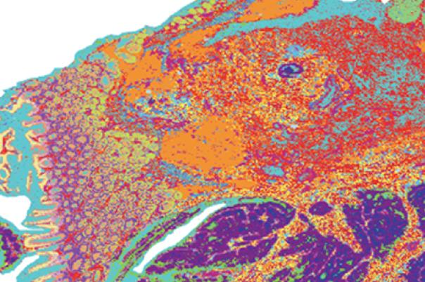 How mapping the spatial biology of the tumor microenvironment can benefit cancer drug discovery and development