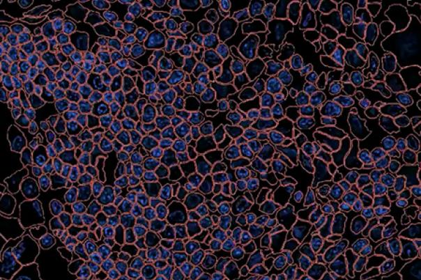 Xenium for drug development: Analyzing cancer survivors, profiling lead compounds